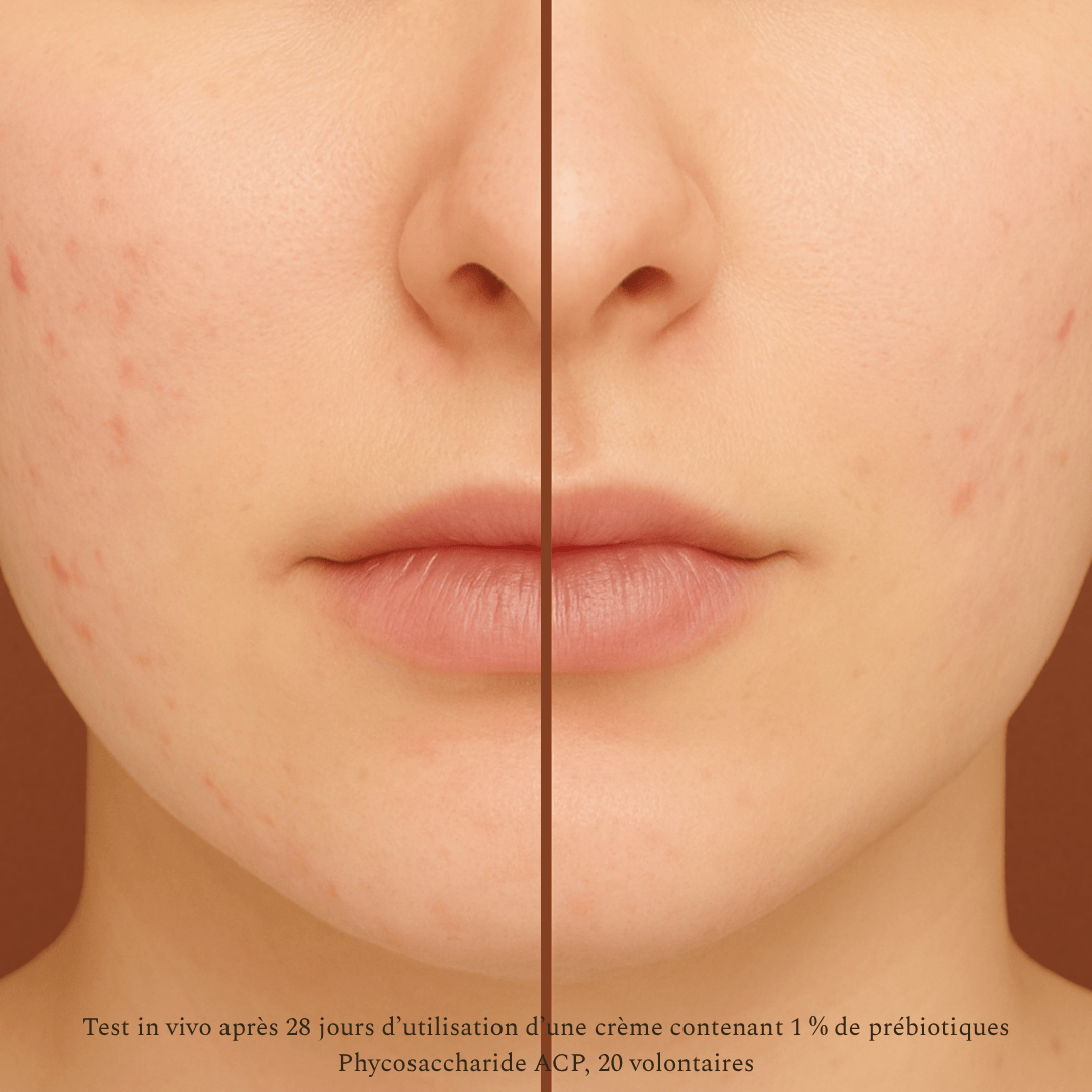 Duo Anti-imperfections Nettoyant (Sérum + Nettoyant visage)